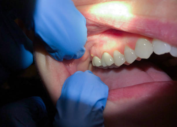 Best Urgent Care for Lost Fillings or Crowns in Jasmine Estates, FL